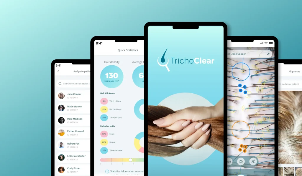 Smart trichoscopy application